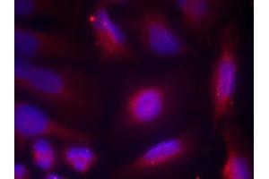 Immunofluorescence staining of methanol-fixed HeLa cells using TrkA (Phospho-Ser791) Antibody (E011326, Red) (TRKA 抗体  (pSer791))