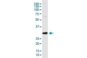 ARV1 monoclonal antibody (M01), clone 4G12. (ARV1 抗体  (AA 1-271))