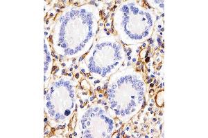 (ABIN657511 and ABIN2846535) staining RHBDF2 in human duodenum tissue sections by Immunohistochemistry (IHC-P - paraformaldehyde-fixed, paraffin-embedded sections). (RHBDF2 抗体  (N-Term))