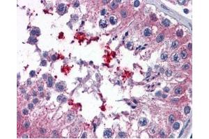 IHC testing of FFPE human testis tissue with ABCD4 antibody at 3. (ABCD4 抗体)