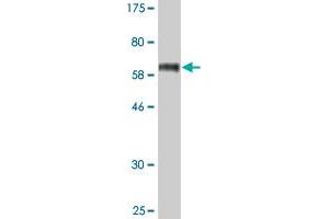 Western Blot detection against Immunogen (63. (STEAP1 抗体  (AA 1-339))