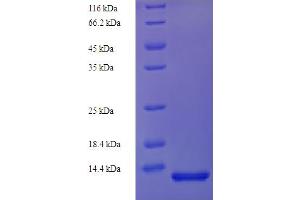 SDS-PAGE (SDS) image for CD81 (CD81) (AA 113-201) protein (His tag) (ABIN5713344)