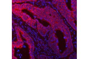 IF analysis of DDX58 using anti-DDX58 antibody (ABIN5518906).