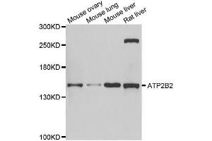 Western blot analysis of extracts of various cell lines, using ATP2B2 antibody. (ATP2B2 抗体  (AA 1-80))
