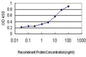 Detection limit for recombinant GST tagged DHODH is approximately 0. (DHODH 抗体  (AA 32-140))