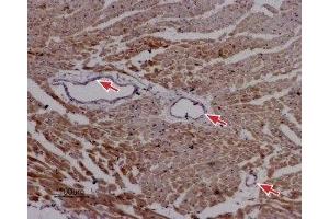 Expression of RyR2 in rat cardiac muscle - Immunohistochemical staining of paraffin-embedded sections of rat myocardium using Anti-Ryanodine Receptor 2 Antibody (ABIN7043605, ABIN7045213 and ABIN7045214), (1:50). (RYR2 抗体  (Intracellular))