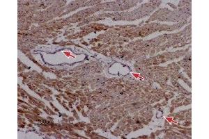Expression of RyR2 in rat cardiac muscle - Immunohistochemical staining of paraffin-embedded sections of rat myocardium using Anti-Ryanodine Receptor 2 Antibody (ABIN7043605, ABIN7045213 and ABIN7045214), (1:50). (RYR2 抗体  (Intracellular, N-Term))