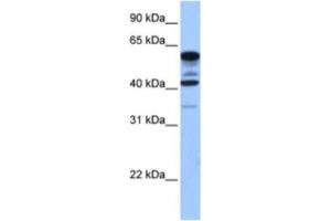 Western Blotting (WB) image for anti-Family with Sequence Similarity 46, Member C (FAM46C) antibody (ABIN2463600)