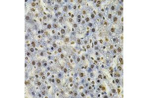 Immunohistochemistry of paraffin-embedded rat liver using IFI16 Antibody (ABIN6129036, ABIN6142162, ABIN6142163 and ABIN6218202) at dilution of 1:100 (40x lens). (IFI16 抗体  (AA 1-300))