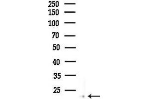 anti-Chromosome 6 Open Reading Frame 108 (C6orf108) (N-Term) antibody
