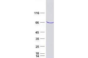Western Blotting (WB) image for Membrane Protein, Palmitoylated 7 (MAGUK p55 Subfamily Member 7) (MPP7) protein (Myc-DYKDDDDK Tag) (ABIN2725819)