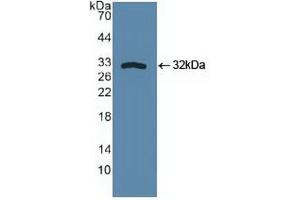 Western blot analysis of recombinant Human SPHK1. (SPHK1 抗体  (AA 148-398))