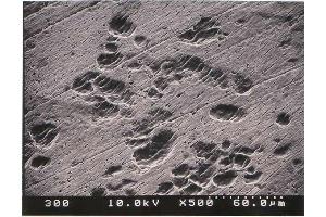 Immunohistochemistry (IHC) image for Osteoclast (Rat) Culture Kit (ABIN956046) (Osteoclast (大鼠) Culture Kit)