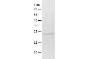 Western Blotting (WB) image for Nuclear Receptor Binding Factor 2 (NRBF2) (AA 45-287) protein (His tag) (ABIN7124210) (NRBF2 Protein (AA 45-287) (His tag))