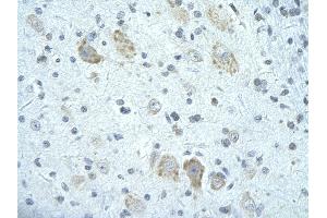 Rabbit Anti-FIP1L1 antibody        Paraffin Embedded Tissue:  Human Brain cell   Cellular Data:  Epithelial cells of renal tubule  Antibody Concentration:   4. (FIP1L1 抗体  (C-Term))