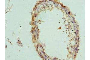 Immunohistochemistry of paraffin-embedded human testis tissue using ABIN7156846 at dilution of 1:100 (IL-2 抗体  (AA 25-176))
