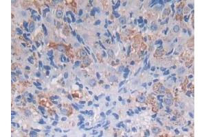 DAB staining on IHC-P; Samples: Mouse Ovary Tissue (PROZ 抗体  (AA 23-399))