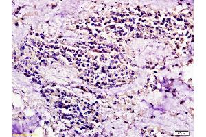 Immunohistochemistry (IHC) image for anti-Chemokine (C-C Motif) Receptor 7 (CCR7) (AA 25-59) antibody (ABIN674724)
