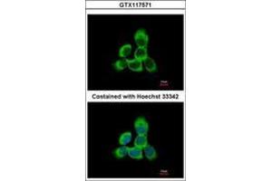 Image no. 3 for anti-Cytoglobin (CYGB) (AA 1-190) antibody (ABIN1501883) (CYGB 抗体  (AA 1-190))