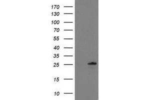 HEK293T cells were transfected with the pCMV6-ENTRY control (Left lane) or pCMV6-ENTRY C1orf50 (Right lane) cDNA for 48 hrs and lysed. (C1ORF50 抗体)