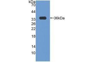 Detection of Recombinant CCND3, Human using Polyclonal Antibody to Cyclin D3 (CCND3)