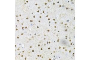 Immunohistochemistry of paraffin-embedded mouse brain using SNRPE Antibody (ABIN1876676) at dilution of 1:200 (40x lens). (SNRPE 抗体)