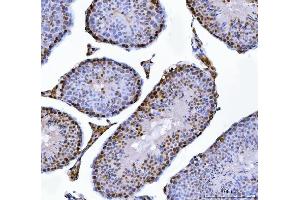 IHC analysis of MBNL1 using anti-MBNL1 antibody (ABIN7602608).