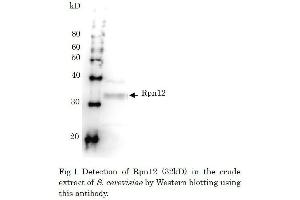 Western Blotting (WB) image for anti-Proteasome (Prosome, Macropain) 26S Subunit, Non-ATPase, 8 (PSMD8) antibody (ABIN2452112) (PSMD8 抗体)