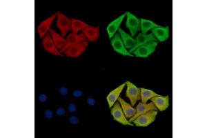 ABIN7096610 and ABIN7100674 staining Hela cells by IF/ICC. (PPP1R12C 抗体)