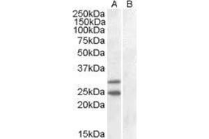 HEK293 overexpressing SOCS1 and probed with ABIN2560058 (mock transfection in lane B). (SOCS1 抗体  (C-Term))