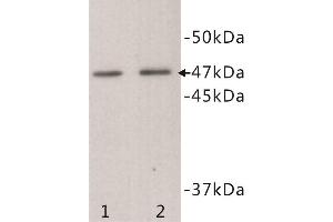 Western Blotting (WB) image for anti-Transmembrane Protein 200A (TMEM200A) antibody (ABIN1854992) (TMEM200A 抗体)