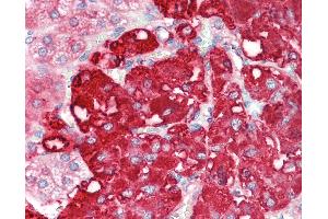 Anti-CMPK2 antibody IHC staining of human adrenal. (CMPK2 抗体  (C-Term))