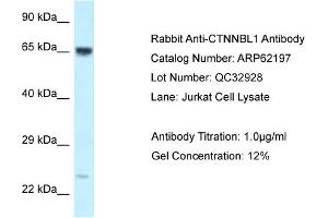 Western Blotting (WB) image for anti-Catenin, beta Like 1 (CTNNBL1) (C-Term) antibody (ABIN2789059) (CTNNBL1 抗体  (C-Term))