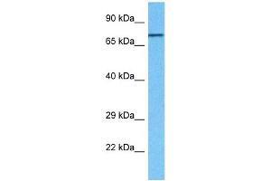 Western Blotting (WB) image for anti-Ras Homolog Gene Family, Member T1 (RHOT1) (N-Term) antibody (ABIN2782020)