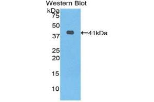 Western blot analysis of the recombinant protein. (KRT6A 抗体  (AA 163-468))