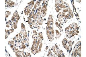 ITGB1BP2 antibody was used for immunohistochemistry at a concentration of 4-8 ug/ml to stain Skeletal muscle cells (arrows) in Human Muscle. (ITGB1BP2 抗体)
