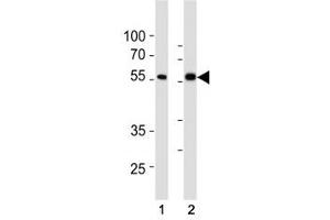 Western Blotting (WB) image for anti-SMAD, Mothers Against DPP Homolog 6 (SMAD6) (AA 358-386) antibody (ABIN3032629)