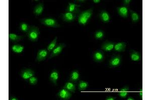 Immunofluorescence of monoclonal antibody to NR1D2 on HeLa cell.