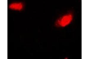 Immunofluorescent analysis of SIRT7 staining in Hela cells. (SIRT7 抗体)