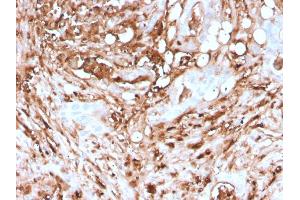 Formalin-fixed, paraffin-embedded human Pancreas stained with Ferritin, Light Chain Recombinant Mouse Monoclonal Antibody (rFTL/1388). (Recombinant FTL 抗体  (AA 38-165))