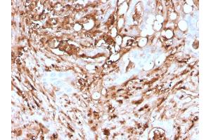 Formalin-fixed, paraffin-embedded human Pancreas stained with Ferritin, Light Chain Recombinant Mouse Monoclonal Antibody (rFTL/1388).
