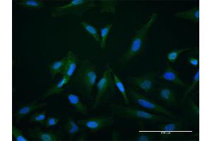 Immunofluorescence of purified MaxPab antibody to SETBP1 on HeLa cell. (SETBP1 抗体  (AA 1-242))