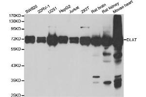 Western blot analysis of extracts of various cell lines, using DLAT antibody. (DLAT 抗体)