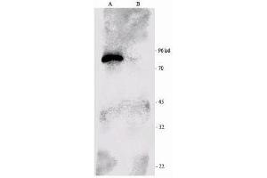 Western-blot analysis of p90 RSK1 immunoprecipitated from the mouse brain extract (B) and using RSK1-HRP as a probe. (RPS6KA1 抗体  (C-Term))