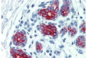 Immunohistochemistry staining of human breast (paraffin-embedded sections) with anti-cytokeratin 7+17 (C-46). (Keratin 7/17 抗体)