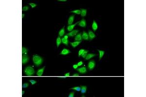 Immunofluorescence analysis of HeLa cells using NFS1 Polyclonal Antibody (NFS1 抗体)