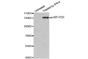 Western blot analysis of extracts from HeLa cells, using Phospho-KIT-Y721 antibody (ABIN2988115). (KIT 抗体  (pTyr721))