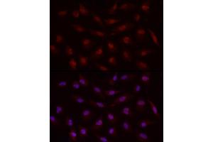 Immunofluorescence analysis of A-549 cells using Smad7 Rabbit pAb (ABIN6133913, ABIN6148093, ABIN6148095 and ABIN6215945) at dilution of 1:50 (40x lens). (SMAD7 抗体  (AA 1-100))