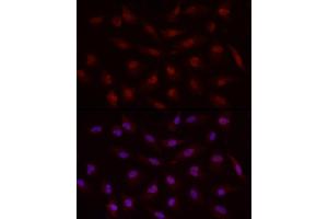 Immunofluorescence analysis of A-549 cells using Smad7 Rabbit pAb (ABIN6133913, ABIN6148093, ABIN6148095 and ABIN6215945) at dilution of 1:50 (40x lens). (SMAD7 抗体  (AA 1-100))