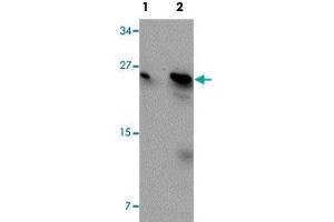 Western blot analysis of MCF-7 cells with BCAS2 polyclonal antibody  at (Lane 1) 0. (BCAS2 抗体  (C-Term))